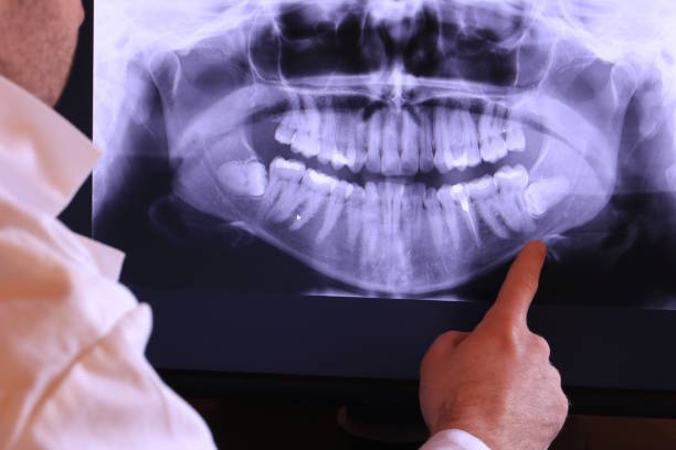 Best Urgent Care for Lost Fillings or Crowns in Troy, TN