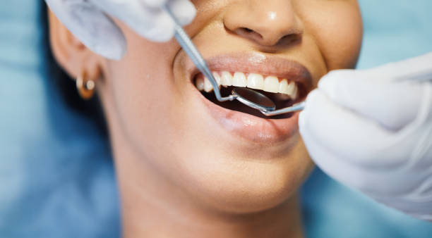 Best Emergency Treatment for Dental Infections or Abscesses in Troy, TN
